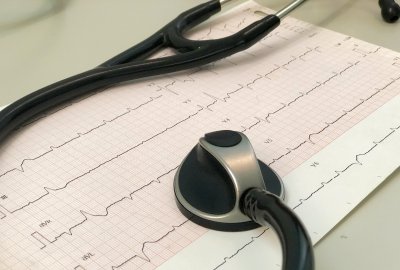 Imagem representando - Eletrocardiograma - ECG em Repouso